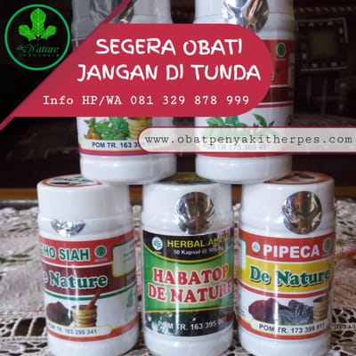 OBAT CACAR ULAR YANG PALING AMPUH