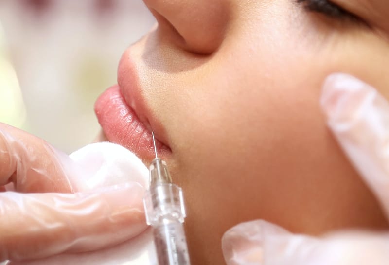 Dermal Fillers