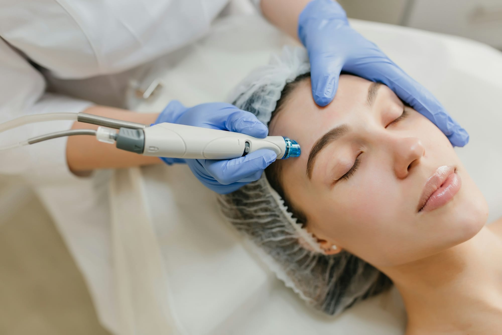 The Real Benefits of Botox Facial Treatments—Beyond Smooth Skin