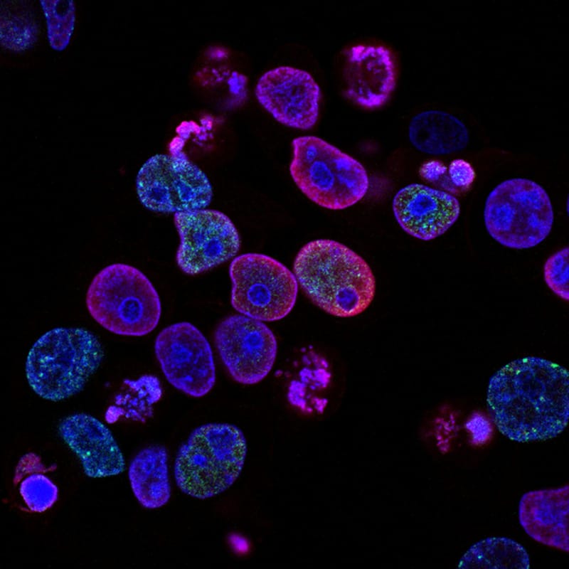 MIT Engineers Employ Fluorescent Labels to Investigate Molecular Interactions in Cell Behavior