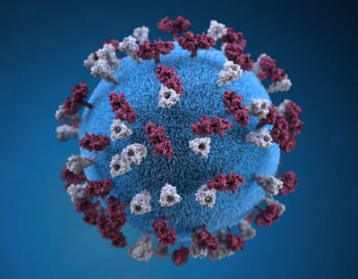 lung infections and Bronchiectasis image