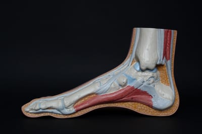 Plantar Fasciitis Reflexology image