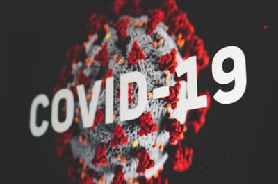 Supply Chain and Technology Innovation during COVID-19 Outbreak