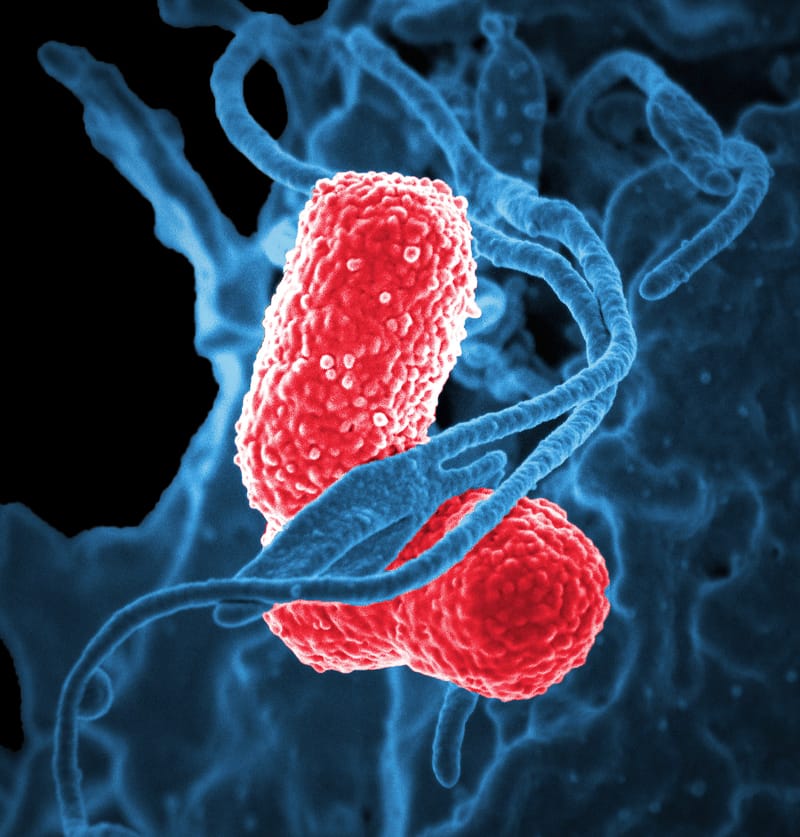 Sanatatea microbiomului intestinal