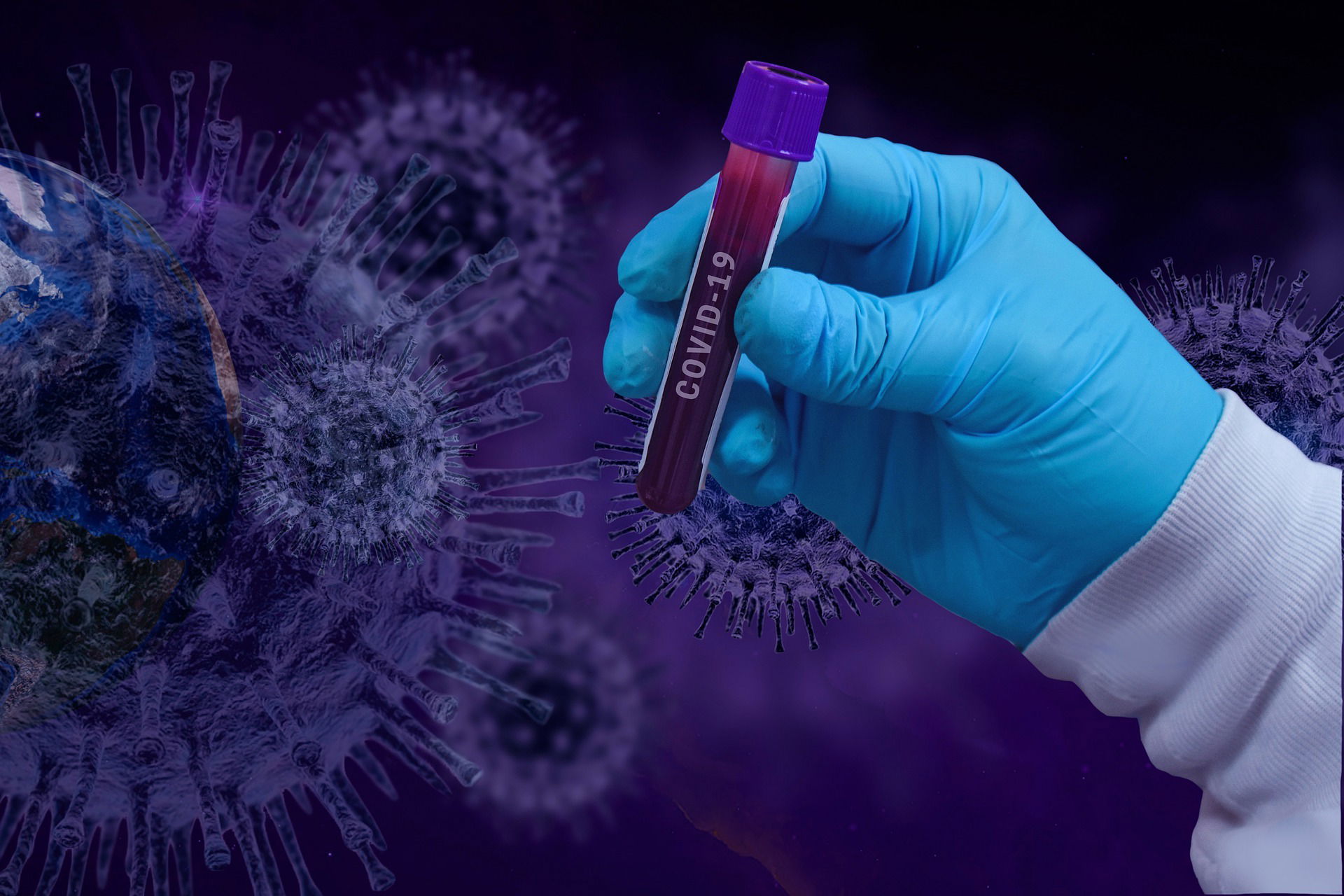 COVID-19 researchers test positive for Coronavirus, but not because they were infected