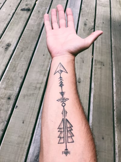 Laser Tattoo Removal Precautions and Evaluation