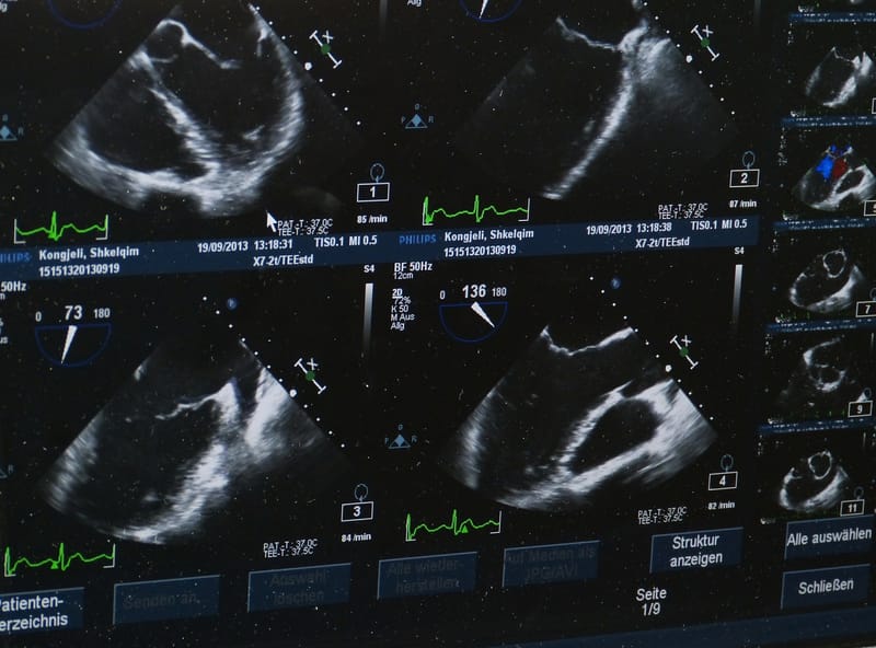 Wearable ultrasound scanner could reveal early stage cancer