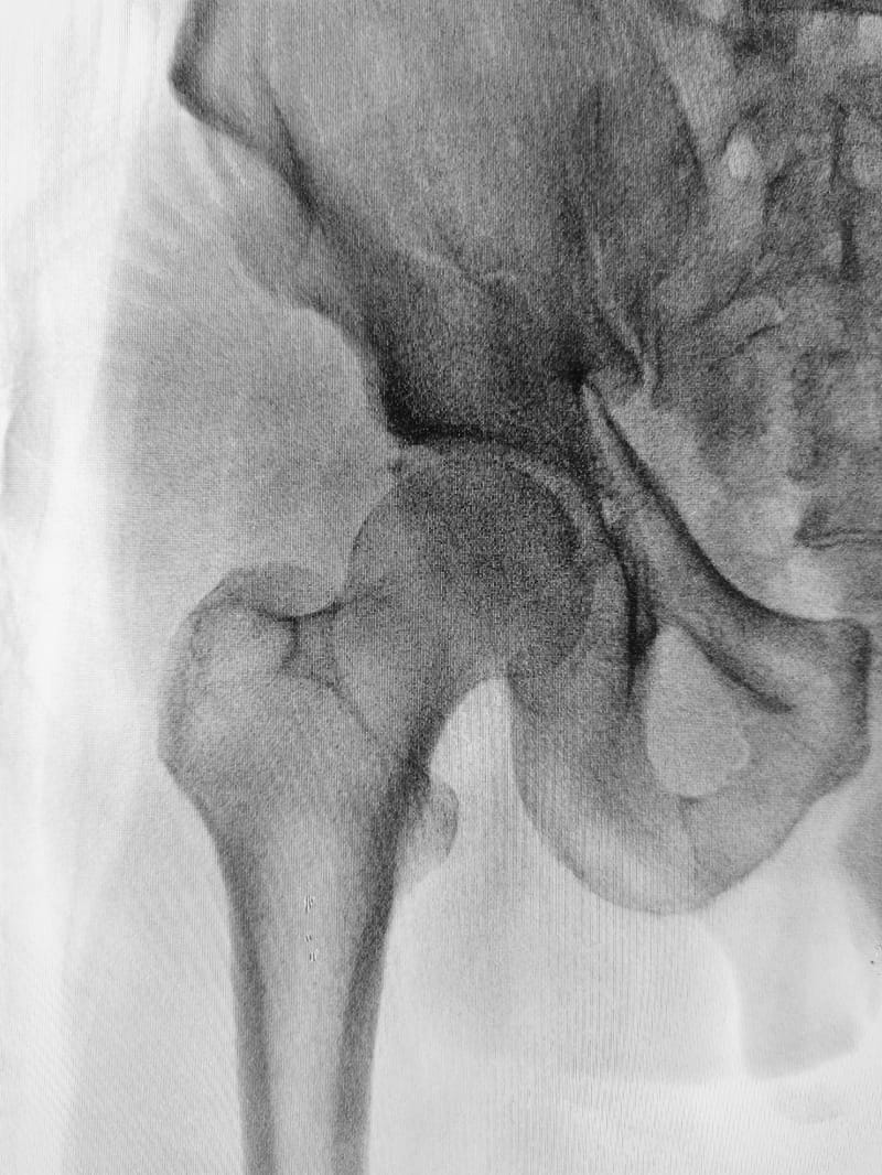 Athletic Injuries & Prevention: 11 & 12th grade