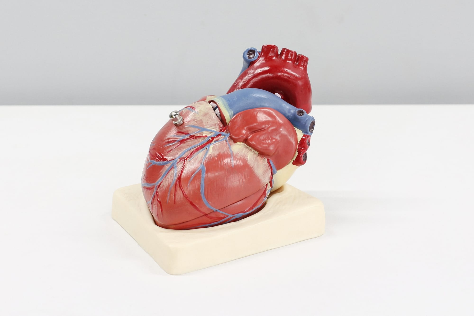 Angina Classification (Heart Attack Discovery)