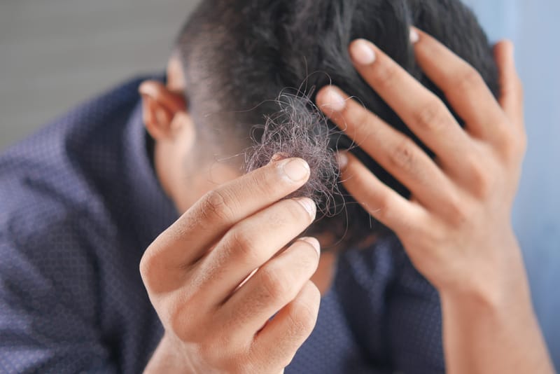 Hair Loss Management