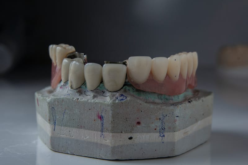 Restorative Dentistry