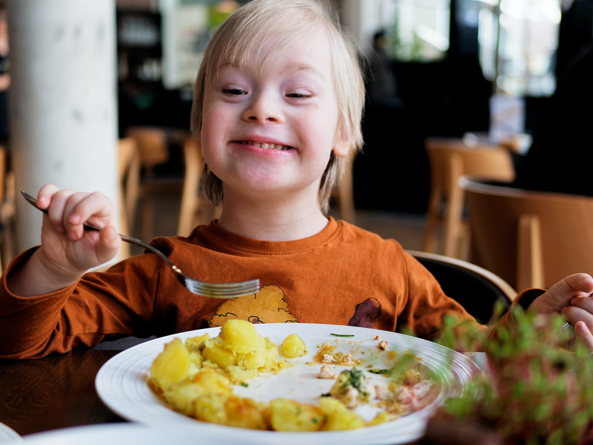 Alimentación del niño con Síndrome de Down