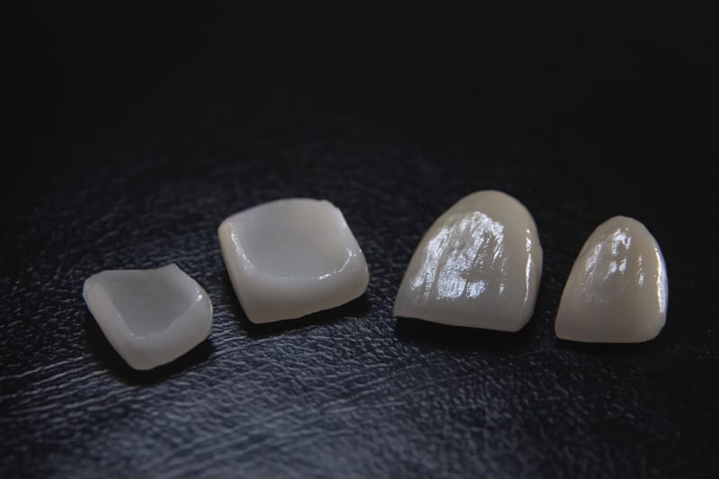 Porcelain Veneers