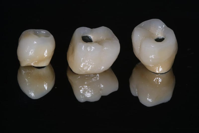 Próteses Dentárias