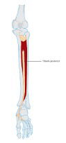 tibialis posterior