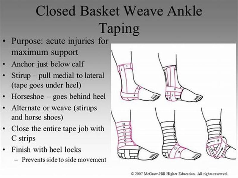 Closed Basketweave Ankle Taping