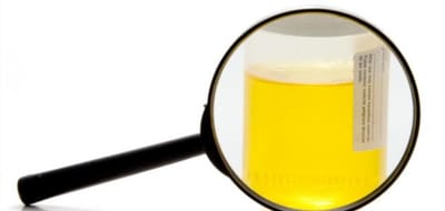 ما هي أعراض التهاب البول