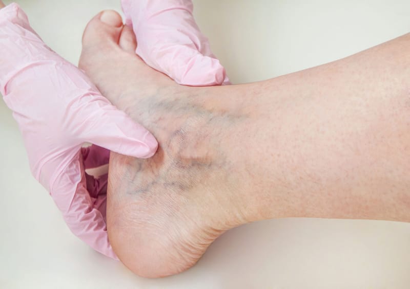 Warning Signs I Never Ignored During My Vein Doctor Search