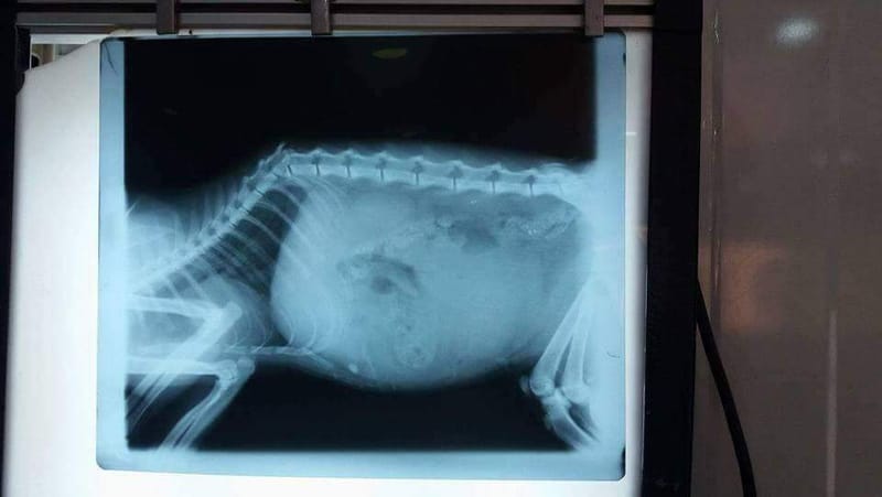 كسر في العامود الفقري