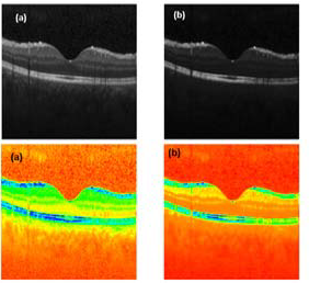 Lightweight Mimic denoising