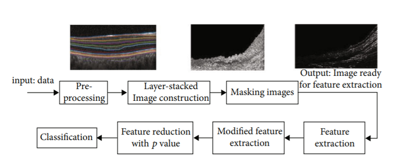 OCT Texture Analysisto differentiate HC and MS