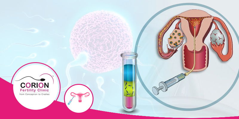 In which cases IVF can be used as infertility treatment?