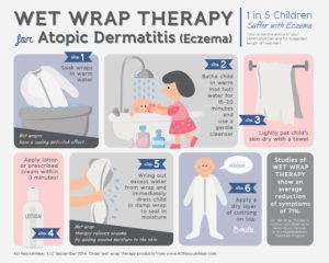 Things I Learned About Getting Eczema Treatment