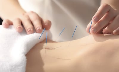 Acupuncture for Fertility: How Does It Work?