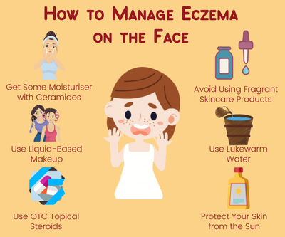 How to Manage Eczema on the Face