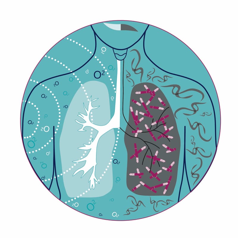 Libération du tabac en 2 séances