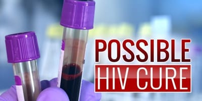 HIV Cure is possible