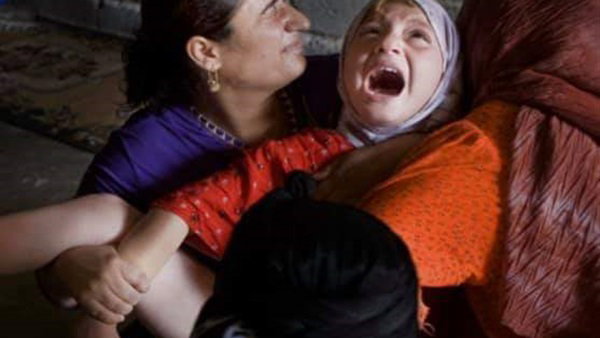 تشويه الأعضاء التناسلية الأنثوية