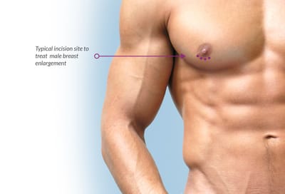 Quick Performing Man Development - Remedies towards Hard work Prompt and Basic!