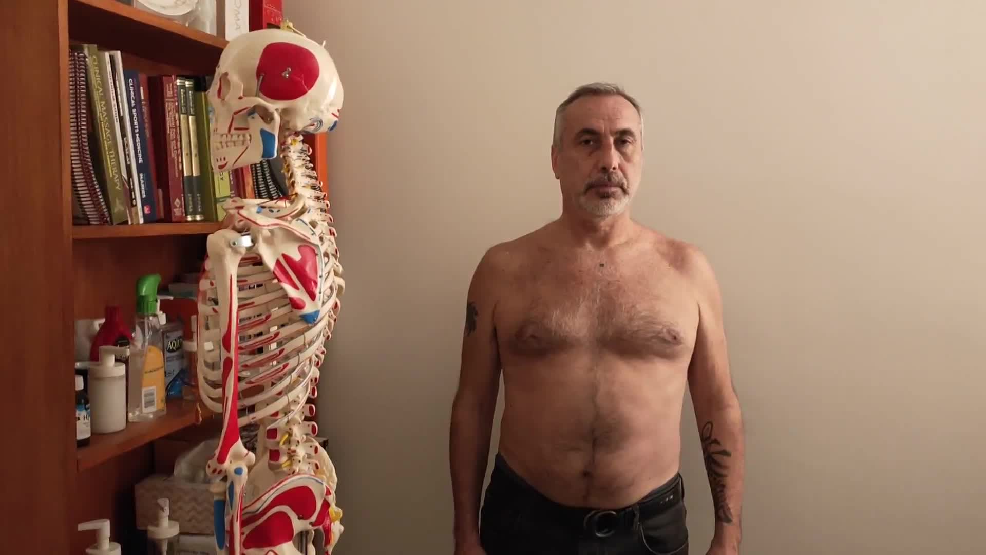 After treatment -  shoulder issue 1