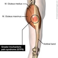 greater trochanter