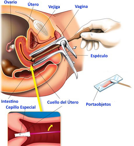 Los pasos a seguir en la toma de citología.