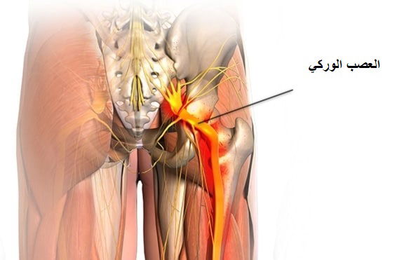 التحقيق في حديث علاج عرق النسا