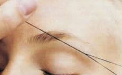 Haarentfernung (Gesicht, Augenbrauen)