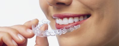 Health Awareness: Few Things to Know About Mouthguards
