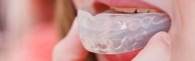 Best Mouthguards for Different Ages: Protecting Smiles from Kids to Adults