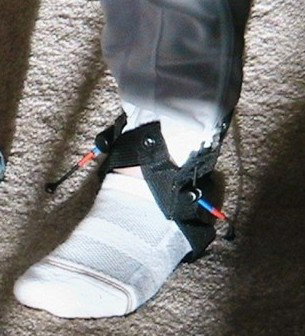 THE RION'S BELT CORDS: