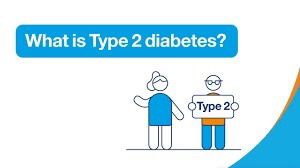 Type 2 Diabetes