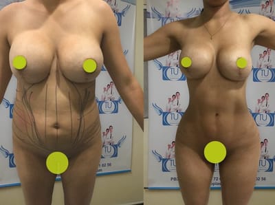 Check out these before and after plastic surgery pics