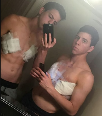 Identical twin sisters become twin brothers after both come out as transgender and undergo gender reassignment