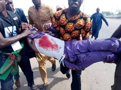 Security Operatives Shoot At Shiite Muslims In Abuja. Graphic Photos