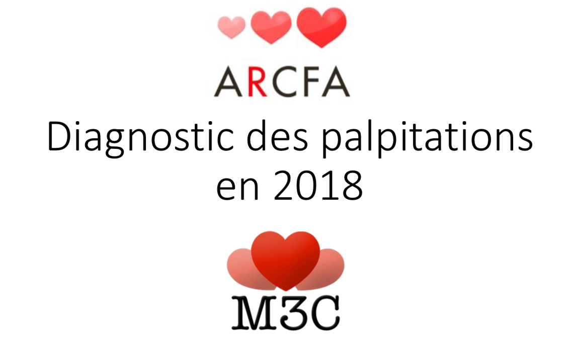 Diagnostic des palpitations en 2018