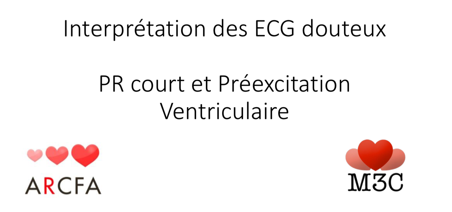 PR court et pré-excitation ventriculaire