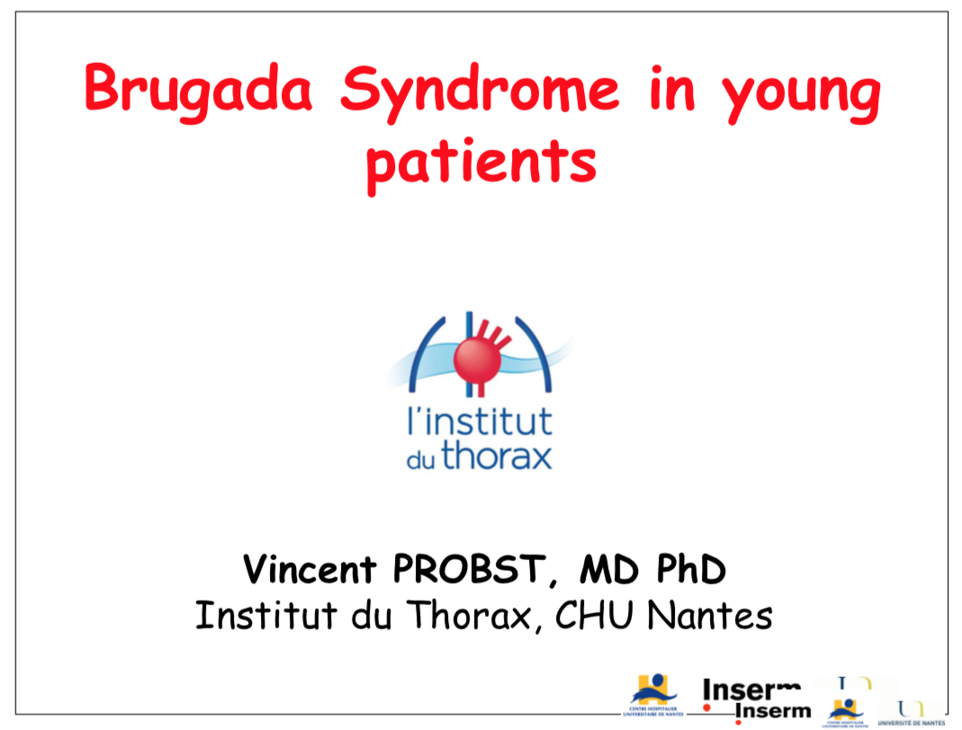 Syndrome de Brugada