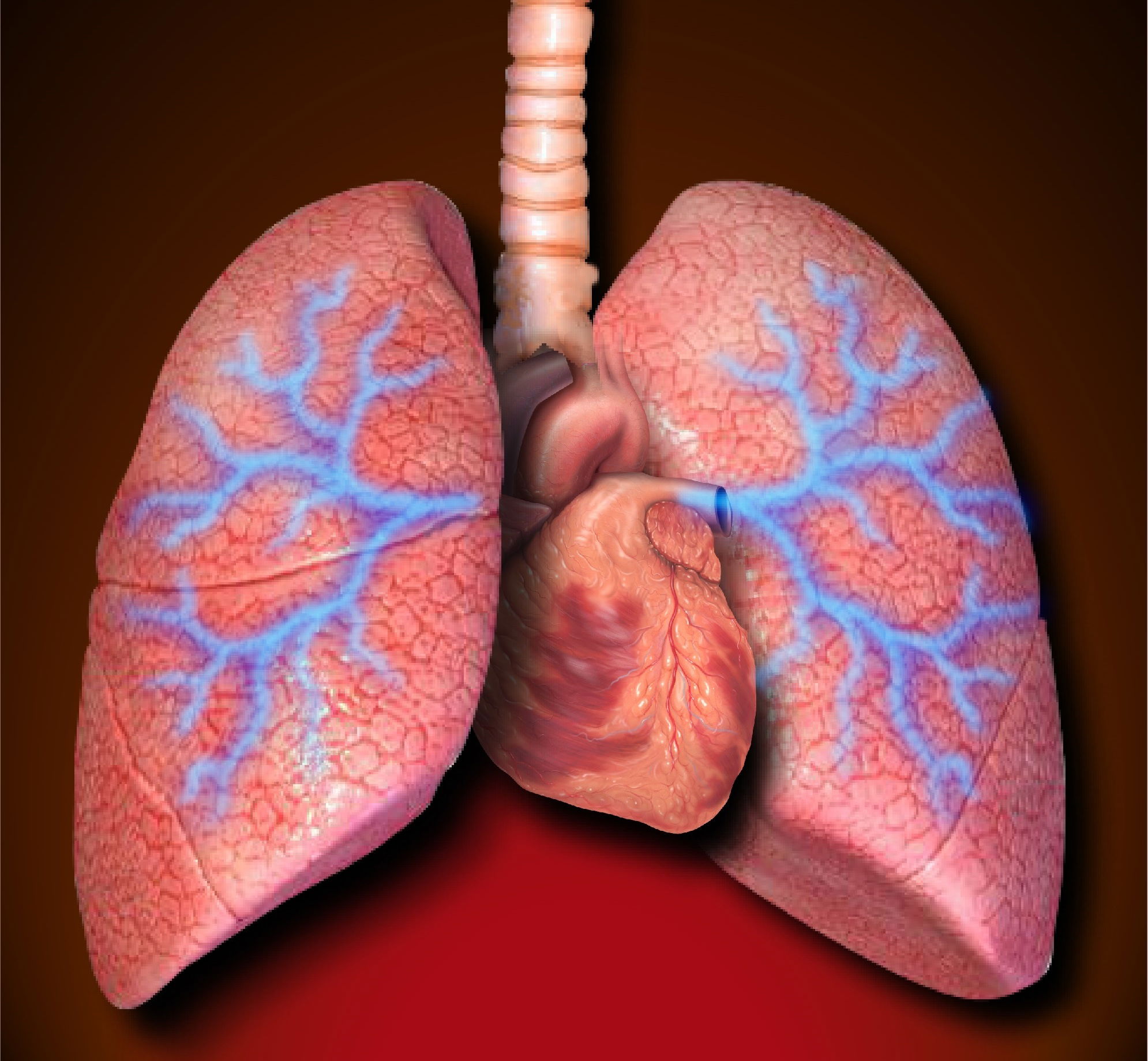 Hypertension pulmonaire de l'enfant