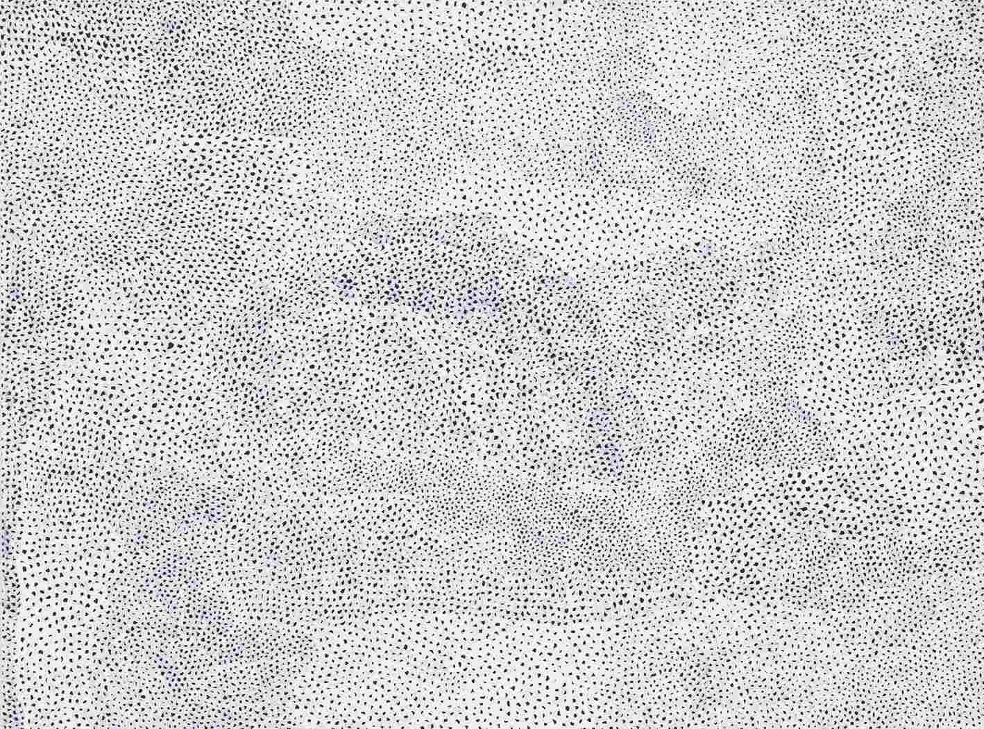 Infinity Nets (5)